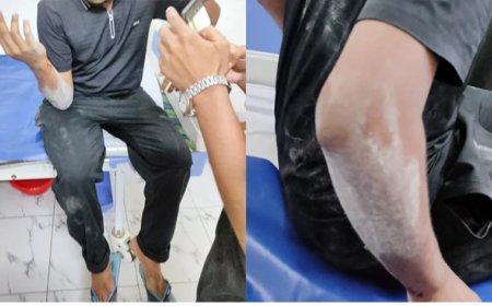 KUET Unrest: Student Leaders Assaulted Amid Protest Over Vice-Chancellor