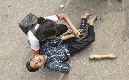 July Jolt: Prosthetic Hand Shattered in Clash